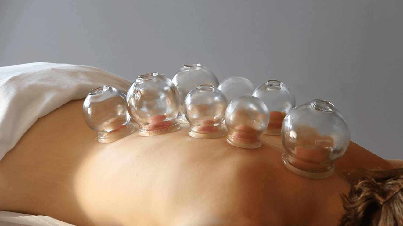 Masaje con Ventosas